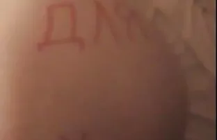 XXX Bambino ferito, spogliarsi per la video amatoriali xxx italiani musica