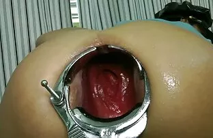 XXX Plesso dei quattro corpi in coppia video sex italiani amatoriali sesso